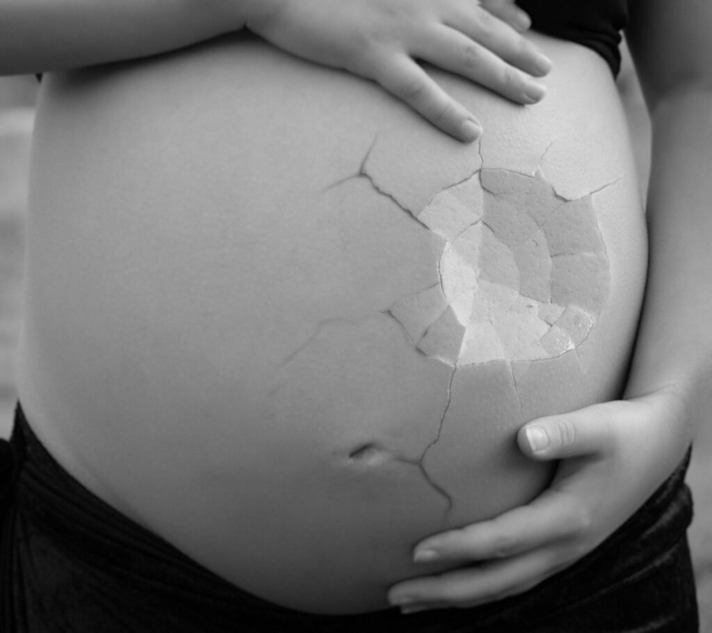 Como Lidar Com A Perda Gestacional E A Infertilidade Como Lidar Com A Perda Gestacional E A Infertilidade